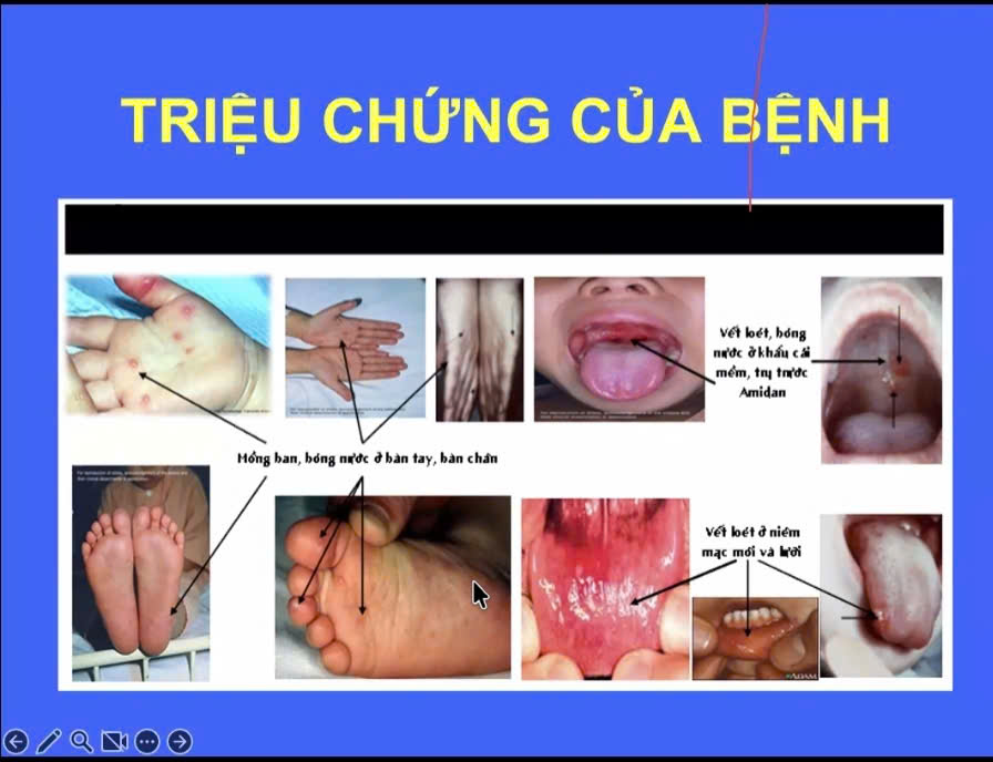 Dấu hiệu TCM